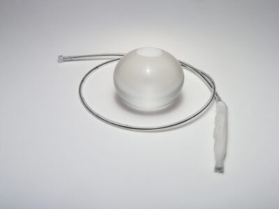 the orbera 365 12 month gastric balloon with endoscopic placement device