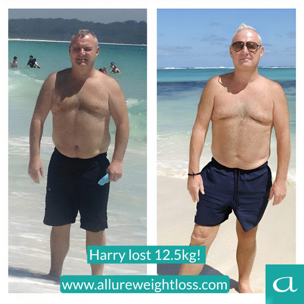 https://allureweightloss.com/wp-content/uploads/2024/06/harry-caase-story.jpeg